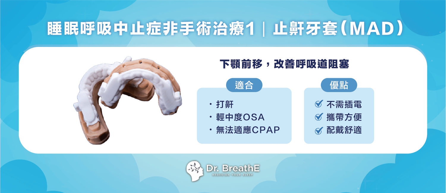 睡眠呼吸中止症非手術治療1|止鼾牙套(MAD)