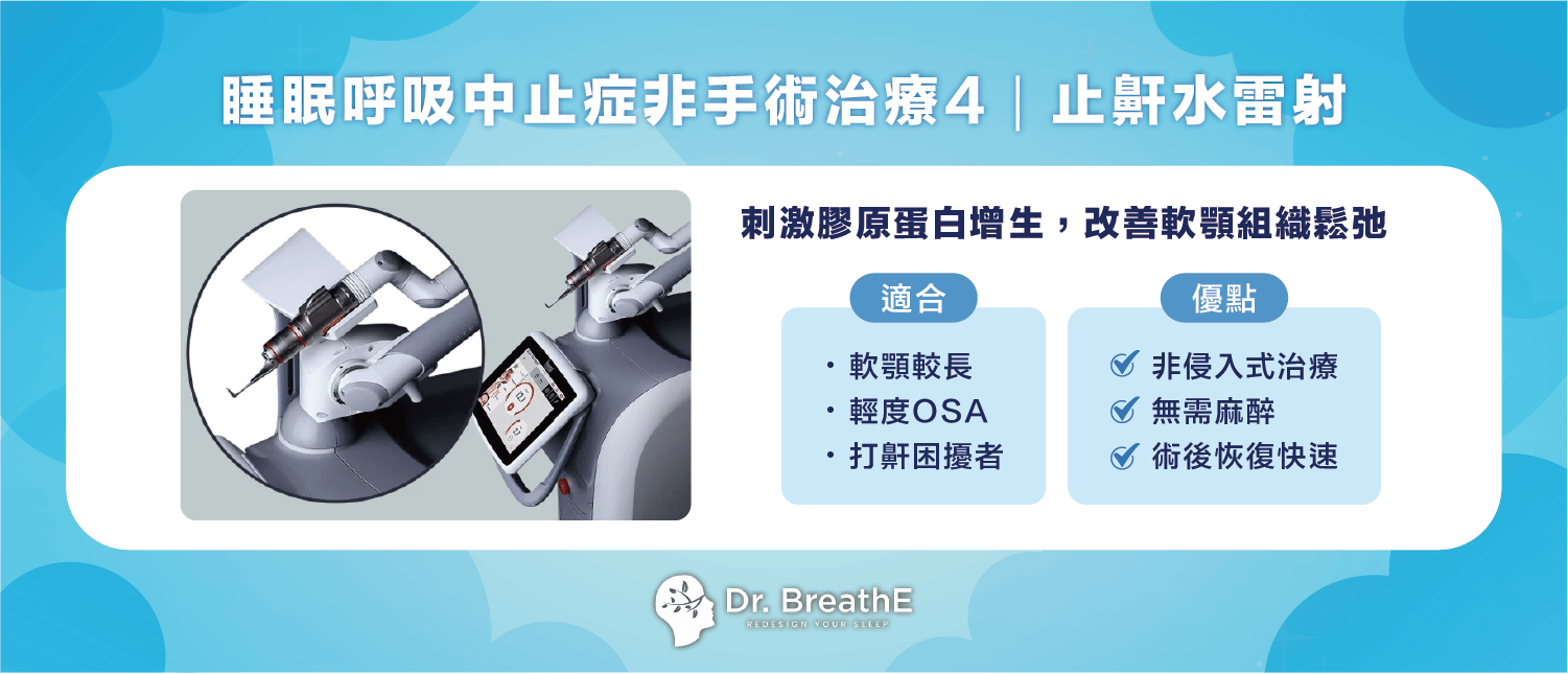 睡眠呼吸中止症非手術治療4|止鼾水雷射