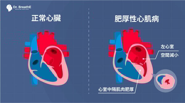 241008_部落格KV_1000x555px_3