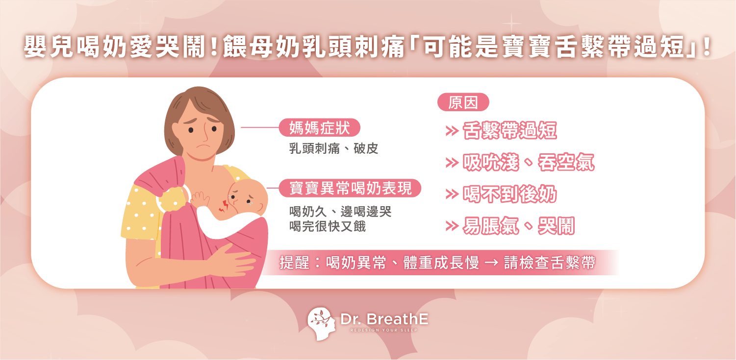 嬰兒喝奶愛哭鬧!餵母奶乳頭刺痛「可能是寶寶舌繫帶過短」!