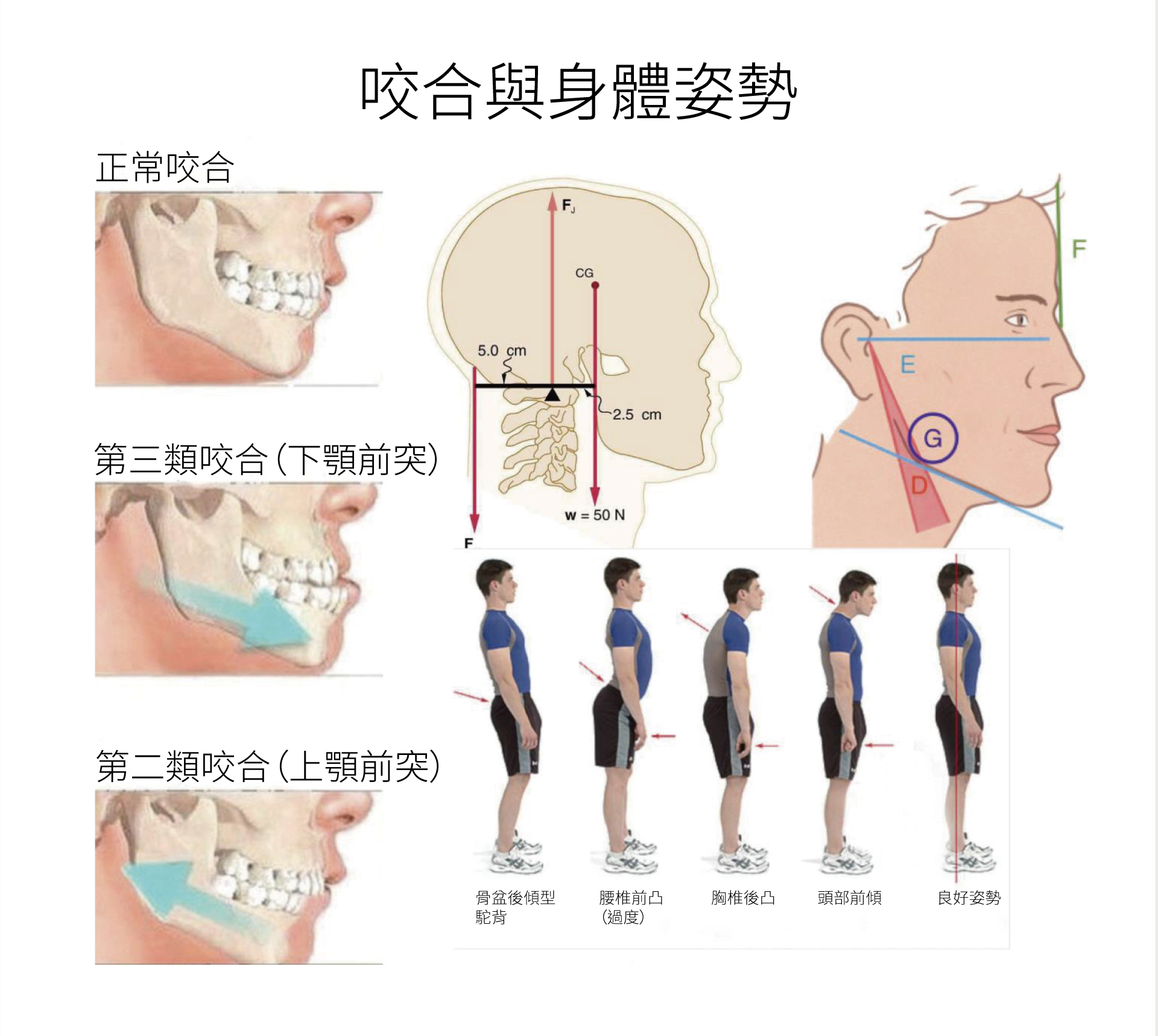 咬合與身體姿勢