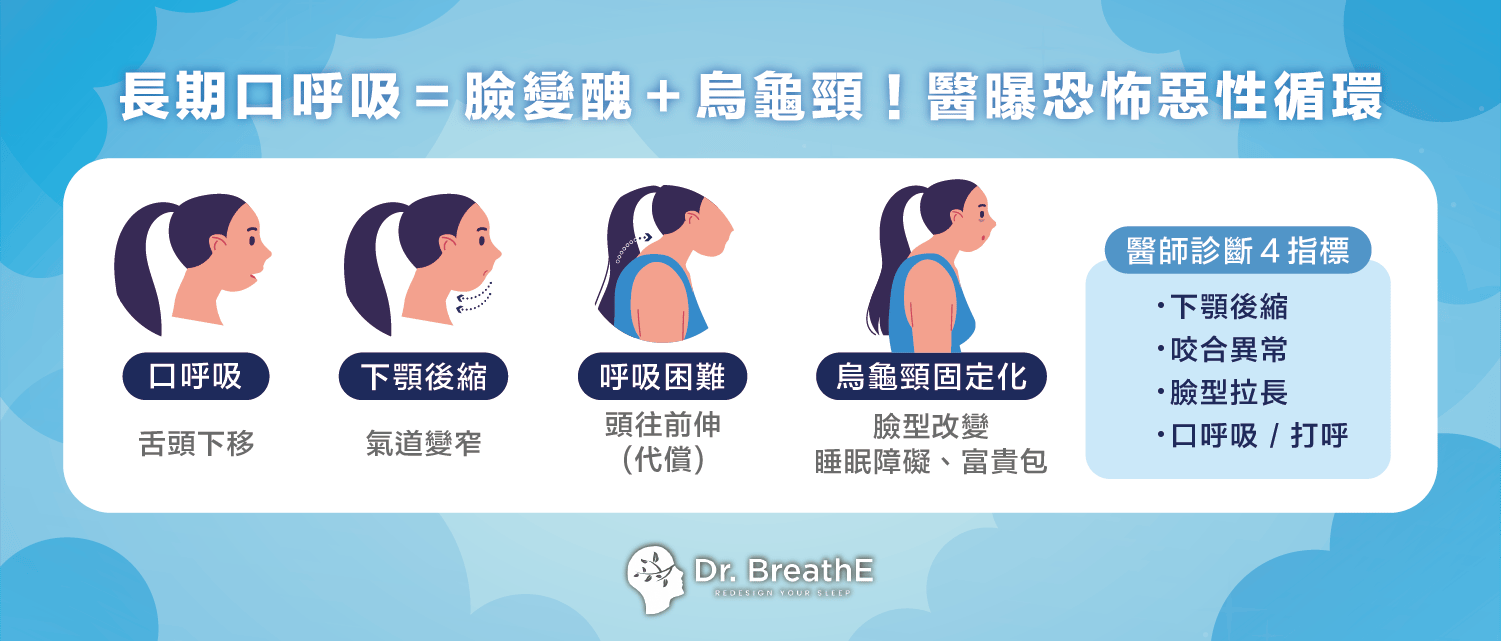 長期口呼吸=臉變醜+烏龜頸!醫曝恐怖惡性循環