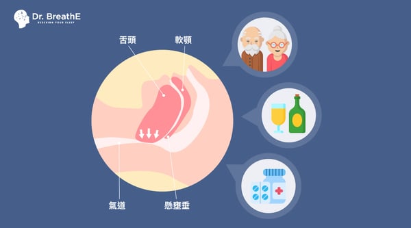 打呼 原因