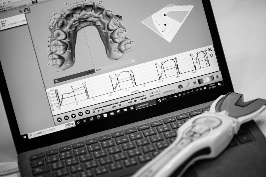 顳顎關節電腦分析咬合