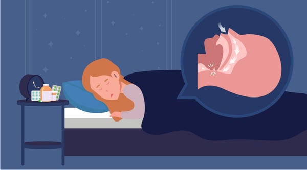 睡眠呼吸中止症