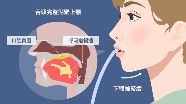 舌頭完整貼緊上顎