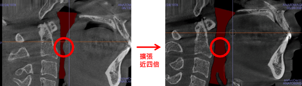 case_01_after