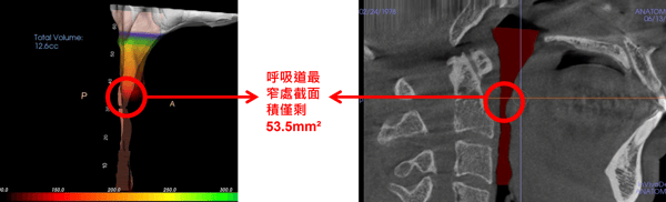 case_01_before