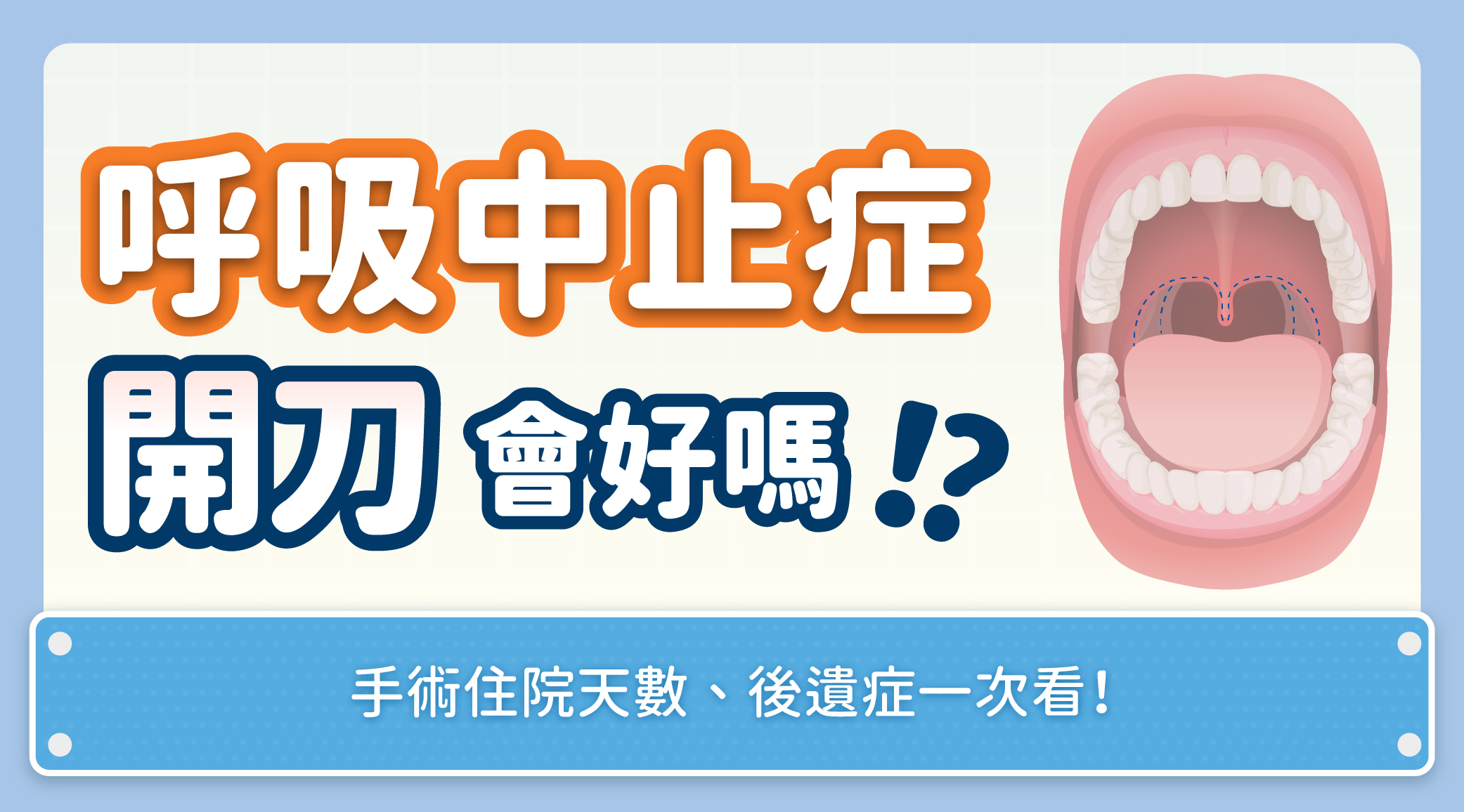 呼吸中止症開刀會好嗎？手術住院天數、後遺症一次看！