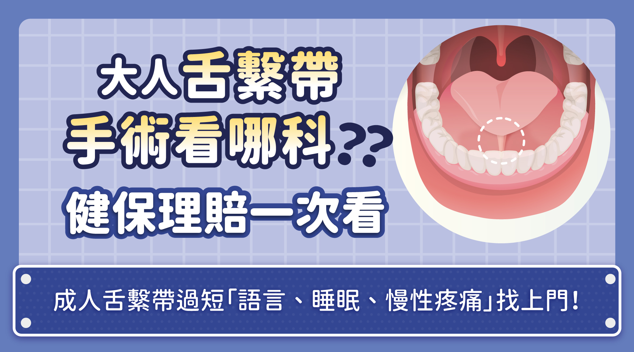 成人舌繫帶看哪一科