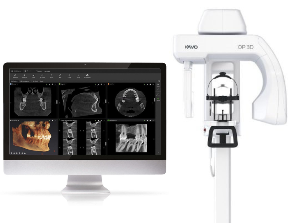 CBCT-1