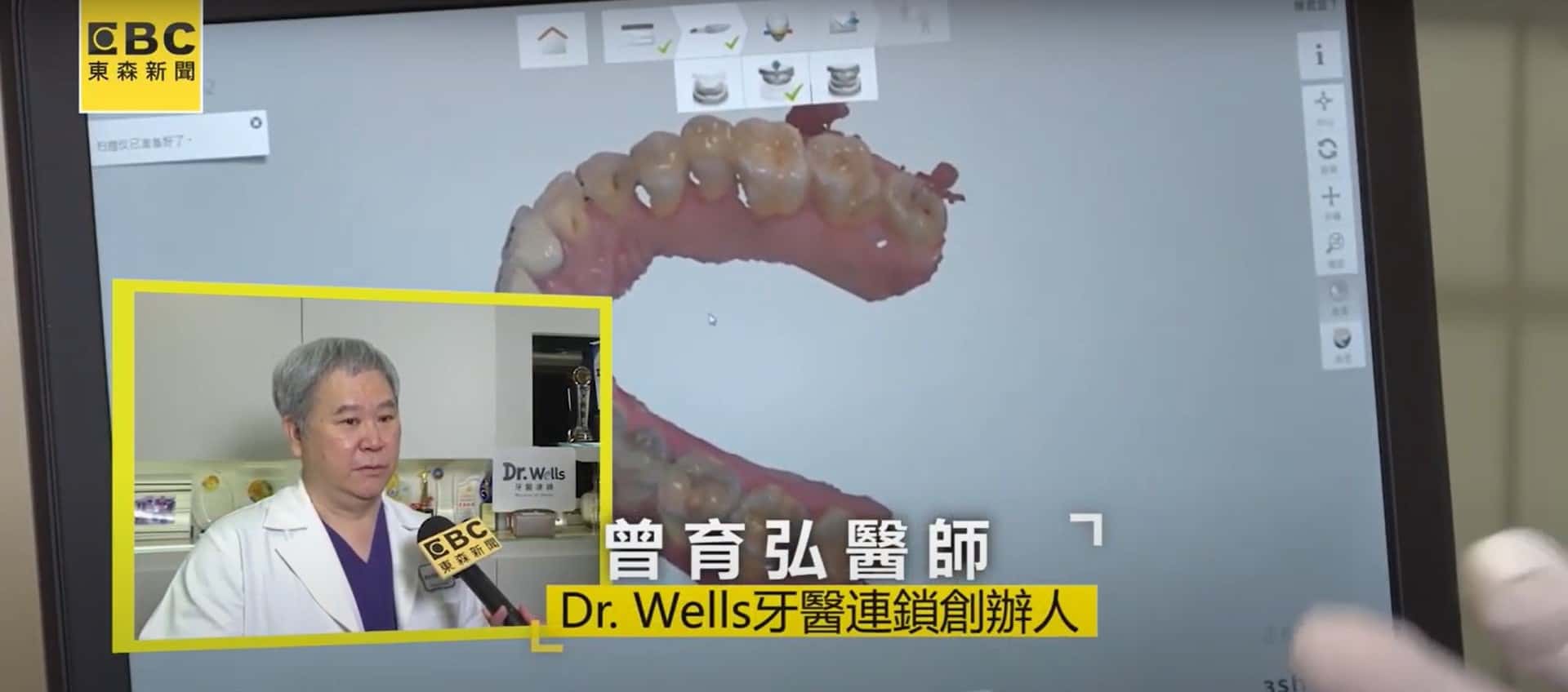 呼吸中止症治療太冗長? 牙醫「數位化」加速止鼾療程!