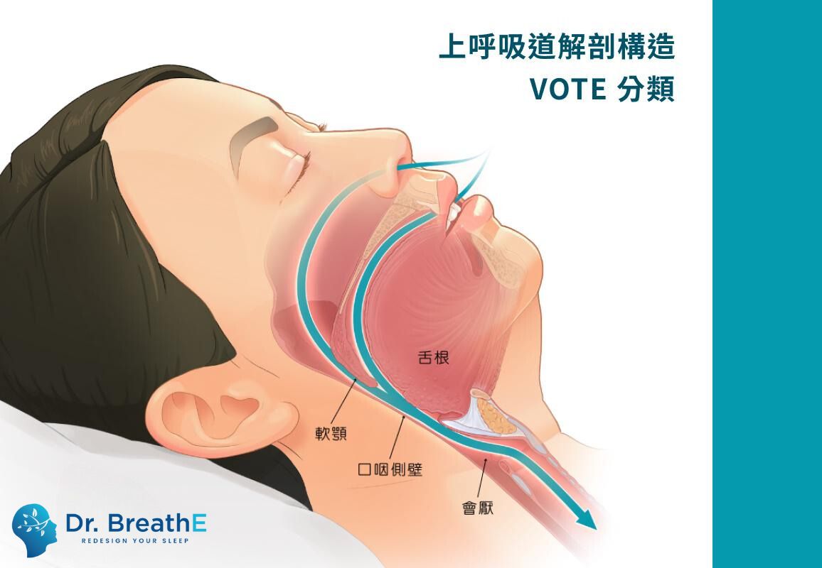 OSA VOTE